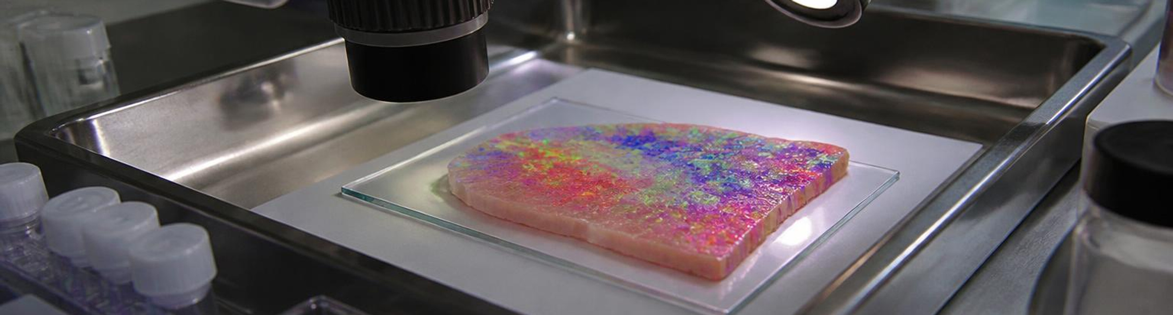 Spatial transcriptomics reveals molecular programs linked to heart-transplant rejection